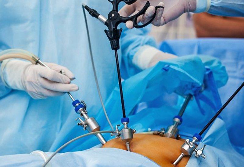General Laparoscopic Surgery